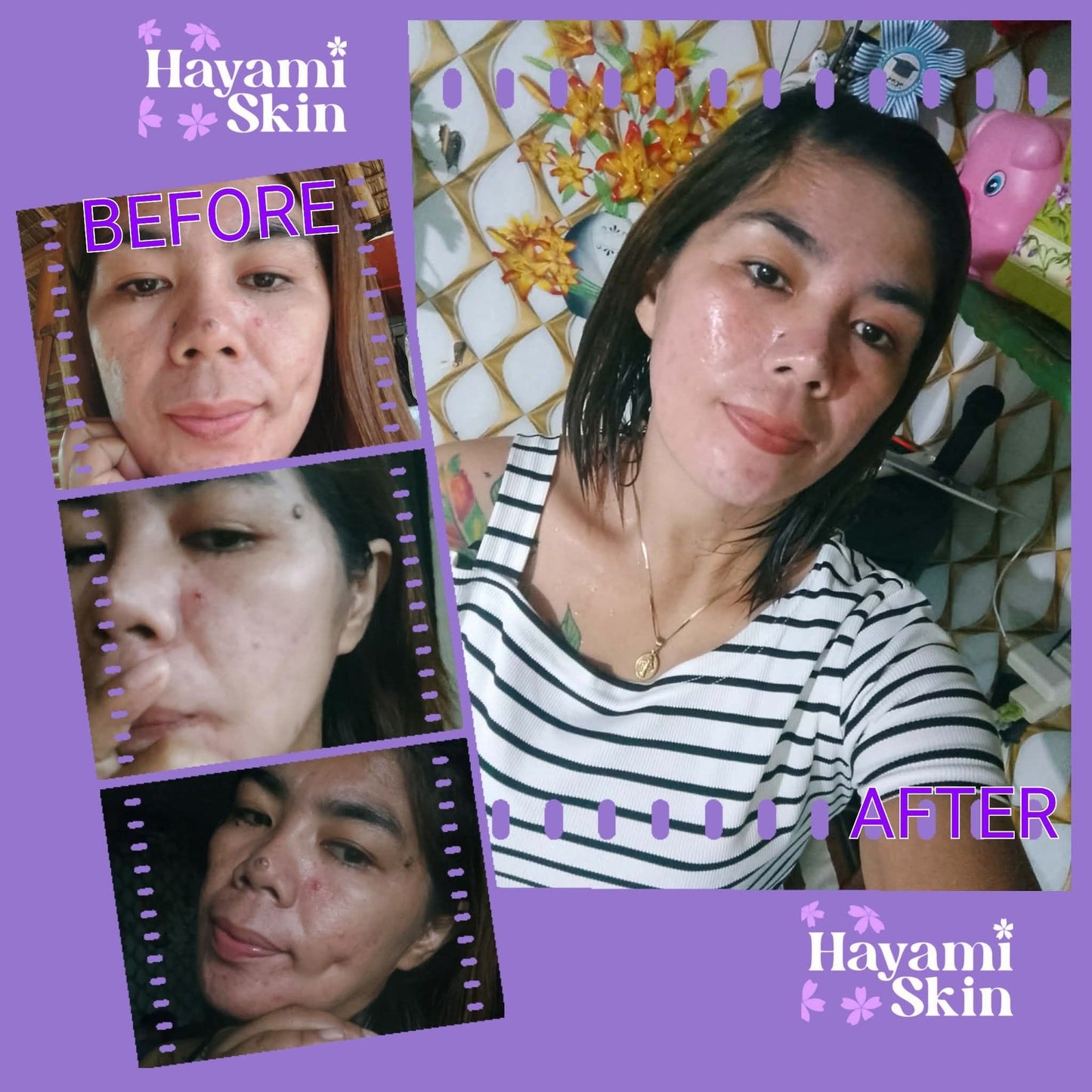Hayami Skin Rejuv Set with Niacinamide
